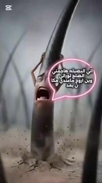 كلينك روز • زراعة شعر • المنسور شارع 14