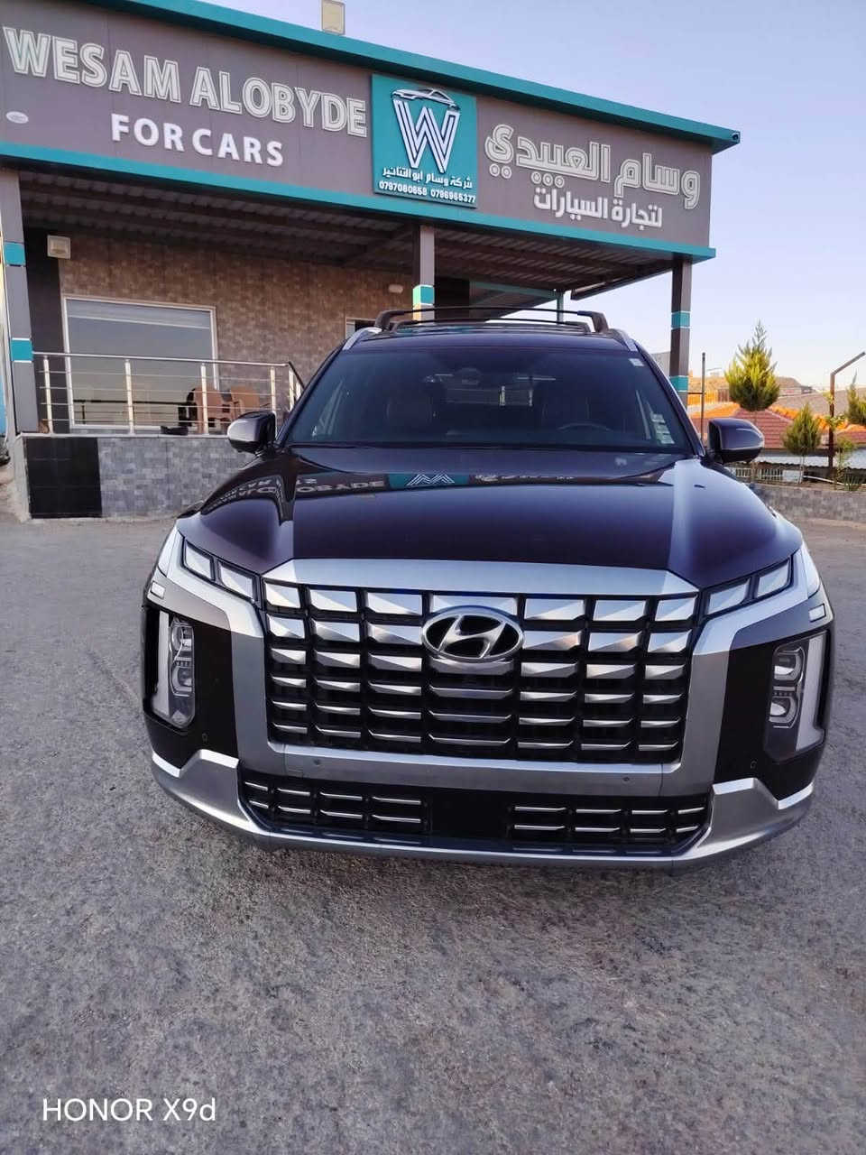 نـــوع الســـيارة /  HYUNDAI PALISADE CALLIGRAPHY

مــوديل الســـيارة / 2024  
           
  * اخي العزيز اضغط متابعة يوصلك كل ماهو جديد *

🎈 السيــارة تدخل عـلى اعــفاء كتــاب الشهـداء 🎈 

حجم المحرك 3.8  
عداد المـسافة / 59 الف mi
مواصفات السيارة :  فول مواصفات (CALLIGRAPHY) اعلى صنف موجود 

 عنوان المعرض ⬅️ في الاردن 📍المنطقة الحرة الزرقاء شـــــارع 18 شـــــمـــال                      

ضرر السيارة واضح في الصور 

الاستفسار او الاتصال واتساب 📞  ***********
