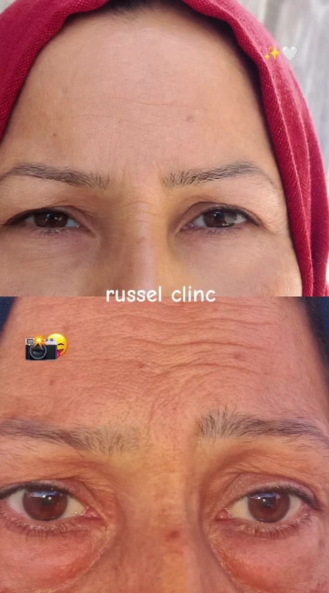 السلام عليكم يشررفنا زيارتكم لصالون russel clinc وعياده الفرع الاول كربلاء حي سلام شارع الكوسترات  نهايته مجاور مكتب المهندس والعياده في حي العباس التواصل واتساب *********** @إشارة
