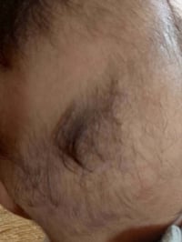 زيت شعر • ٢٠ يوم • توصيل الكوت