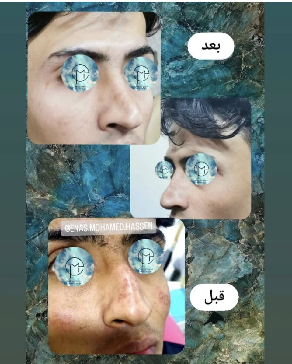 للحجز والاستفسار المراسله خاص
او الاتصال ‭0770 020 8093‬
