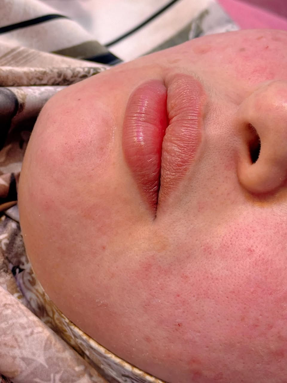 ⁨ الرسمة من بعد ١١ شهر ولا غلطة ❤️‍🔥🫶🏻
📍📍عيادة بيرلي (نبتون)
الحمزة الشرقي جهة شارع الملاحة مقابيل صيدلية نجلاء الشيباني 
واتساب او الاستفسار ***********
#الحمزة_الشرقي #الديوانية #الحمزه_الشرقي #عيادة_بيرلي_نبتون #فلر_شفايف #فلرشفة_فلر_وجنات_فلرخطوط_ضاحكة_فلرذقن_تكساس_تكنيك❤️❤️❤️⁩⁩
