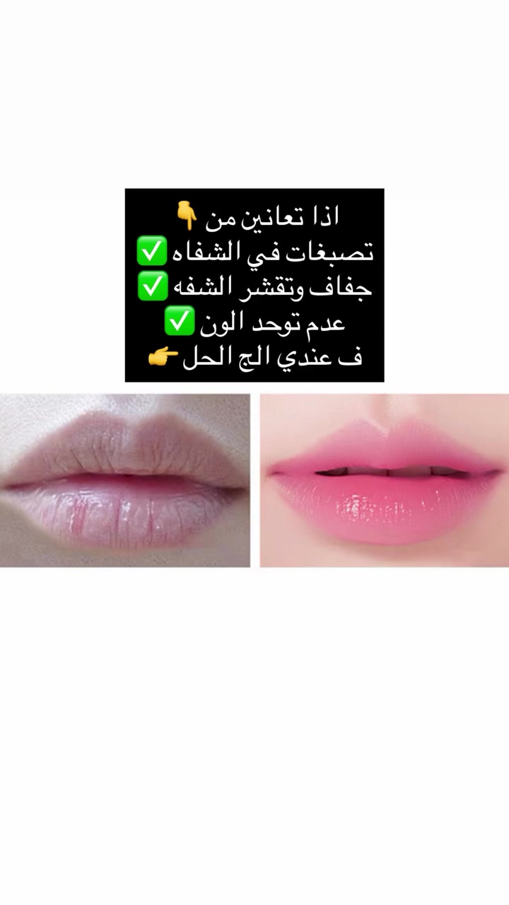 للطلب دايركت ✉️☑️

.

.

#اكسبلور #ترند #الاصلي #الشعب_الصيني_ماله_حل😂😂 #العراق


**إذا كنت صاحب هذا الإعلان وتريد حذفه لأي سبب، رجاءا أرسل رسالة إلى الدعم الفني**