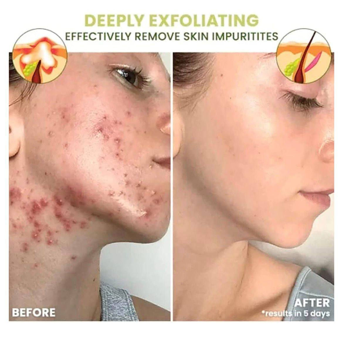 هذا المنتج هو جل الصبار المرطب (Aloe Vera Gel) من علامة تجارية غير محددة بوضوح، يأتي في عبوة بحجم 300 جرام ومناسب لجميع أنواع البشرة.
استخدامات متعددة: يستخدم لترطيب البشرة، تهدئة حروق الشمس، علاج جفاف الجلد، وحتى كبرايمر قبل المكياج أو مغذي للشعر. السعر بالفين 💕 🦋


**إذا كنت صاحب هذا الإعلان وتريد حذفه لأي سبب، رجاءا أرسل رسالة إلى الدعم الفني**