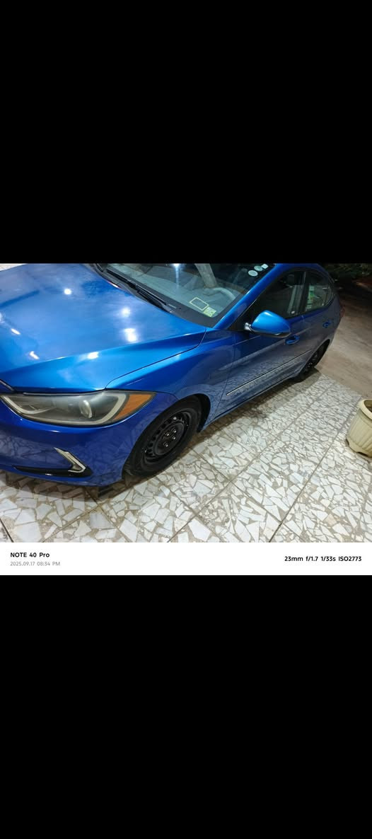 السلام عليكم انتره مديل 2017
حادثه بنيد بدون دواخل وجنطه الموظح بل صوره ابيع قطعتين مكان كربلاء للستفسار اكثر اتصال ***********
