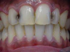 السلام عليكم اي احد عنده هاي الحالات يتواصل وياي العلاج مجاني المكان عيادات جامعه المشرق مقابل ساحة عباس بن فرناس
***********
