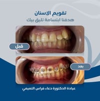 🦷عيادة الدكتورة دعاء فراس التميمي 🦷 -لعلاج الاسنان بالتقويم الشفاف وال...