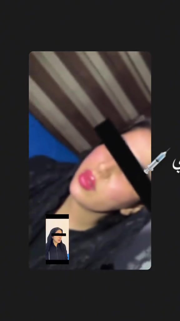 كل هاذه الجمال بعيادة الدكتورة حنين العزاوي Haneen Alazzawy لعنوان مدخل التكسيات قرب كراج الاسدي _عيادات خبراء الطب التخصصي
للحجز ***********
