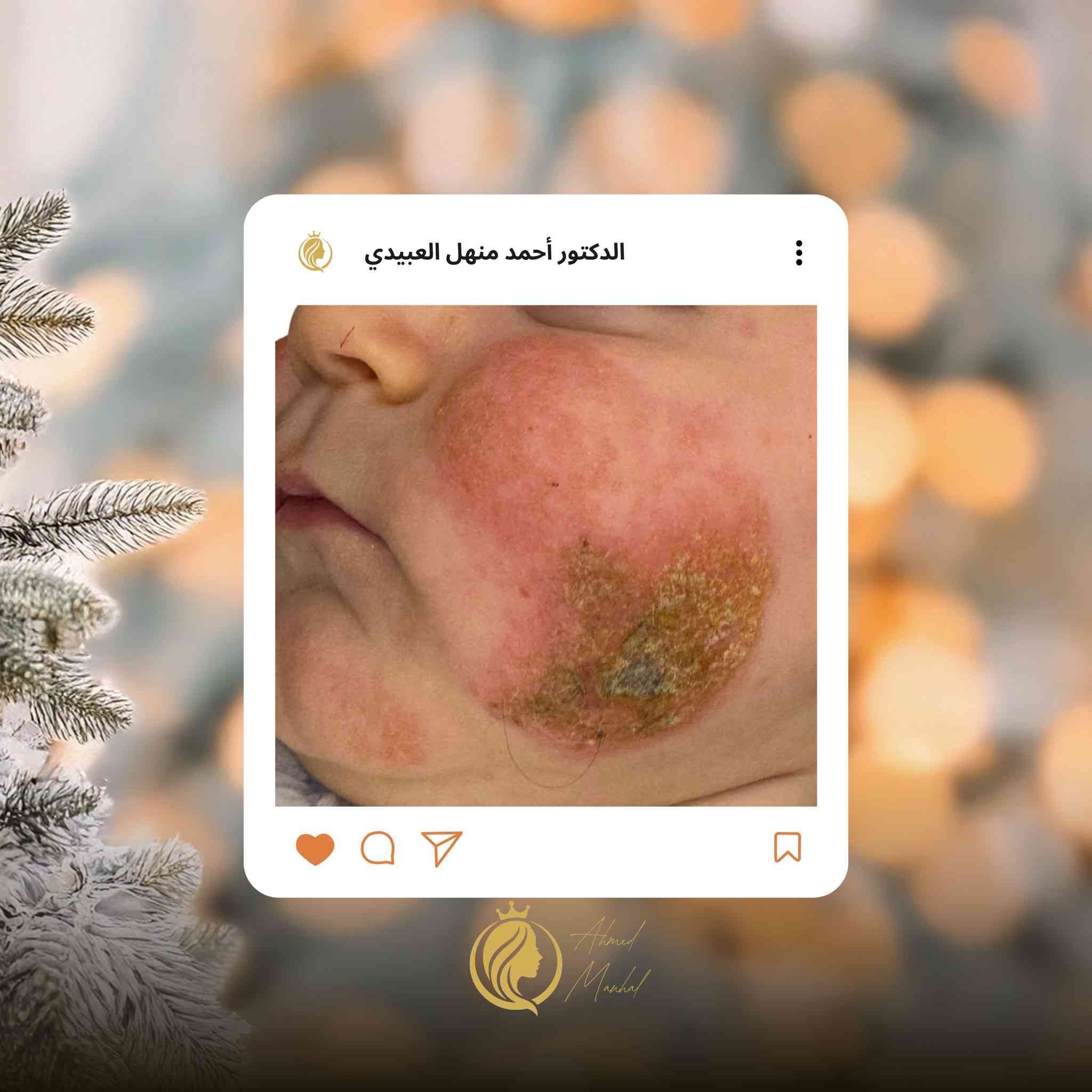 العلاج الصحيح يبدأ بتشخيص مبني على علم وخبرة.
قرارات طبية دقيقة لا تترك مجالًا للتجربة.
هنا تُدار الحالات بثقة،
لأن النتيجة مسؤولية وليست احتمالًا.

عيادة الدكتور أحمد منهل العبيدي
📍 مجمع البرج الأبيض – حي البريد
📞 ***********
📞 ***********
