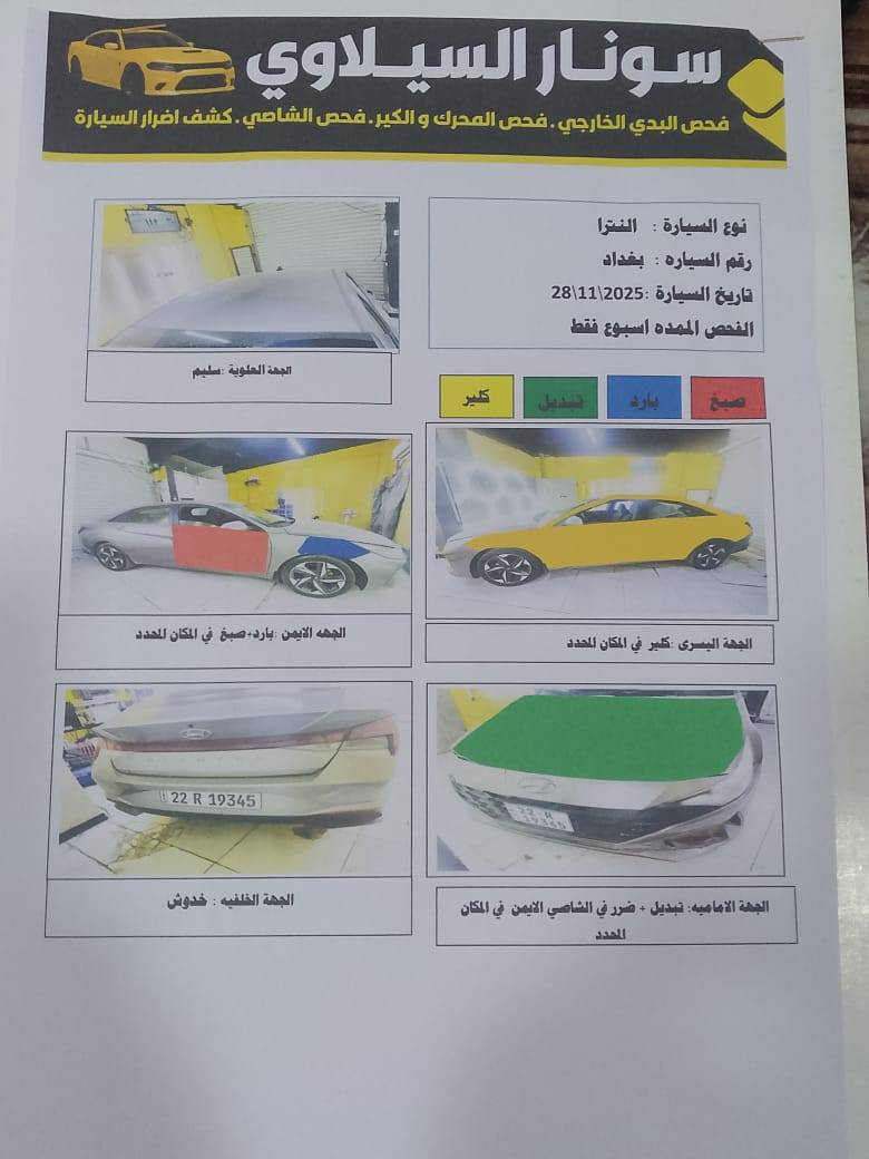 البيع النتراء 23 مامتواجد على الفيس سعر144 هاذ رقمي ***********
