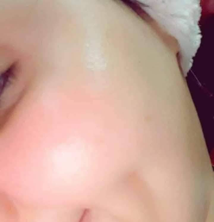 اليوم الخلطة غير شيى جنننن تبيض وتصفيه ونضاره خلطتي معروفه لستنا الوحيدين لاكننا الافضل 😂😉
1-وجه
2-قدم
3-مناطق حساسه
4-خلطه يد
5 - مسمن 
صابون حسب نوع البشره 
مرطب 

#كل الخلطات تنطيج نتيجه رهيبه بحيث حته المكياج تستغنون عنه خلطه لشباب والبنات  😂😂😂

تعالج تصبغات  الكلف حب الشباب 

صعدوا المنشور بطريقكم💜🫶

#وخلي الماسمع يسمع🤌😂


**إذا كنت صاحب هذا الإعلان وتريد حذفه لأي سبب، رجاءا أرسل رسالة إلى الدعم الفني**