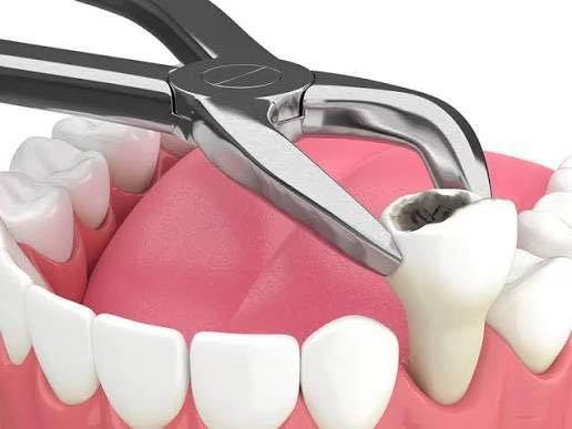 عيادة الكرامه لطب الاسنان متواجدين اليوم في تمام ساعه ٧ مساءً
عنوان جنوب الموصل ناحية الشورة داخل القيصريه مجمع بركات الغيث
***********

