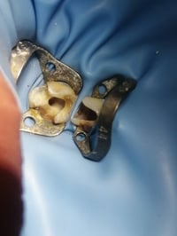 د مهند الطحان • تركيبات اسنان • مستشفى القياره