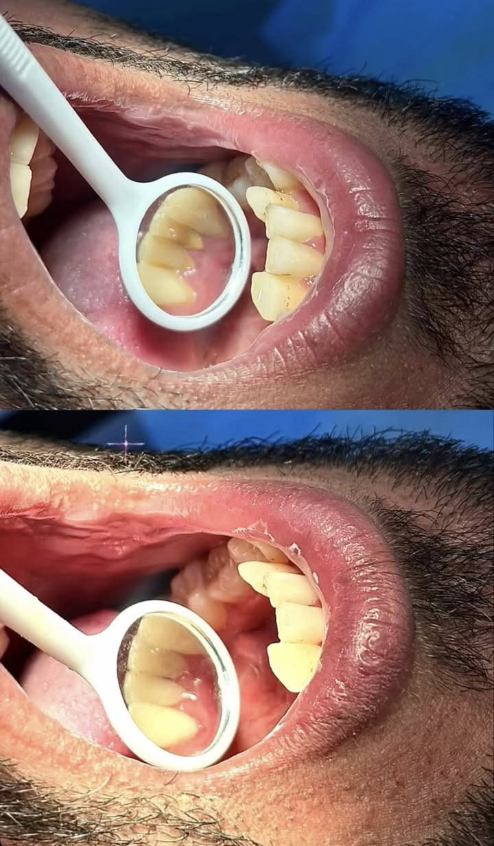 تنظيف وتلميع الاسنان ازاله التكلسات والتصبغات
قلع الجذور التالفه التسبب رائحه كريهه و التهابات في الفم  
قلع المتحركه اللبنية والدائمية
حشو الاسنان بالحشوات الضوئيه والتجميليه
المراسله خاص او على الرقم ***********
الكراده شارع ٥٢
