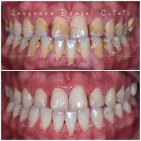 الي عنده نزيف بل للثه او محتاج تنظيف وتبيض يتواصل ع هذه  07744644109