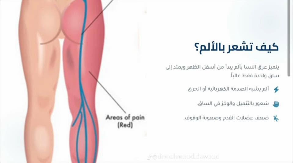 � تعلن عيادة الكوثر للعلاج الطبيعي والحجامة عن عروض مميزة 🌿

هل تعاني من:
✅ آلام الظهر والرقبة
✅ الانزلاق الغضروفي
✅ آلام المفاصل والركب
✅ الشد العضلي والتشنجات
✅ آلام الكتف والرقبة
✅ الإرهاق والتعب العام

نوفر لكم:
🔹 جلسات العلاج الطبيعي بأحدث الطرق
🔹 الحجامة العلاجية والوقائية
🔹 الإبر الصينية
🔹 كادر متخصص وخدمة مميزة
✅ يتوفر كادر نسائي خاص لاستقبال وعلاج النساء بكل خصوصية وراحة

💥 سارع بالحجز واستفد من العروض الخاصة 💥

📍 #العنوان: #الخالدية - #بداية #شارع #أبو #أبوفليس - #مجاورصيدليةنارنج 
📞 #للحجز والاستفسار: #***********او
#الخالديه_رمادي_حديثه_فلوجه_هيت_القائم_بغداد
#آلام_الظهر
#الحجامة
#

عيادة الكوثر للعلاج الطبيعي والحجامة
🌟 راحتكم هدفنا… وصحتكم أولويتنا
