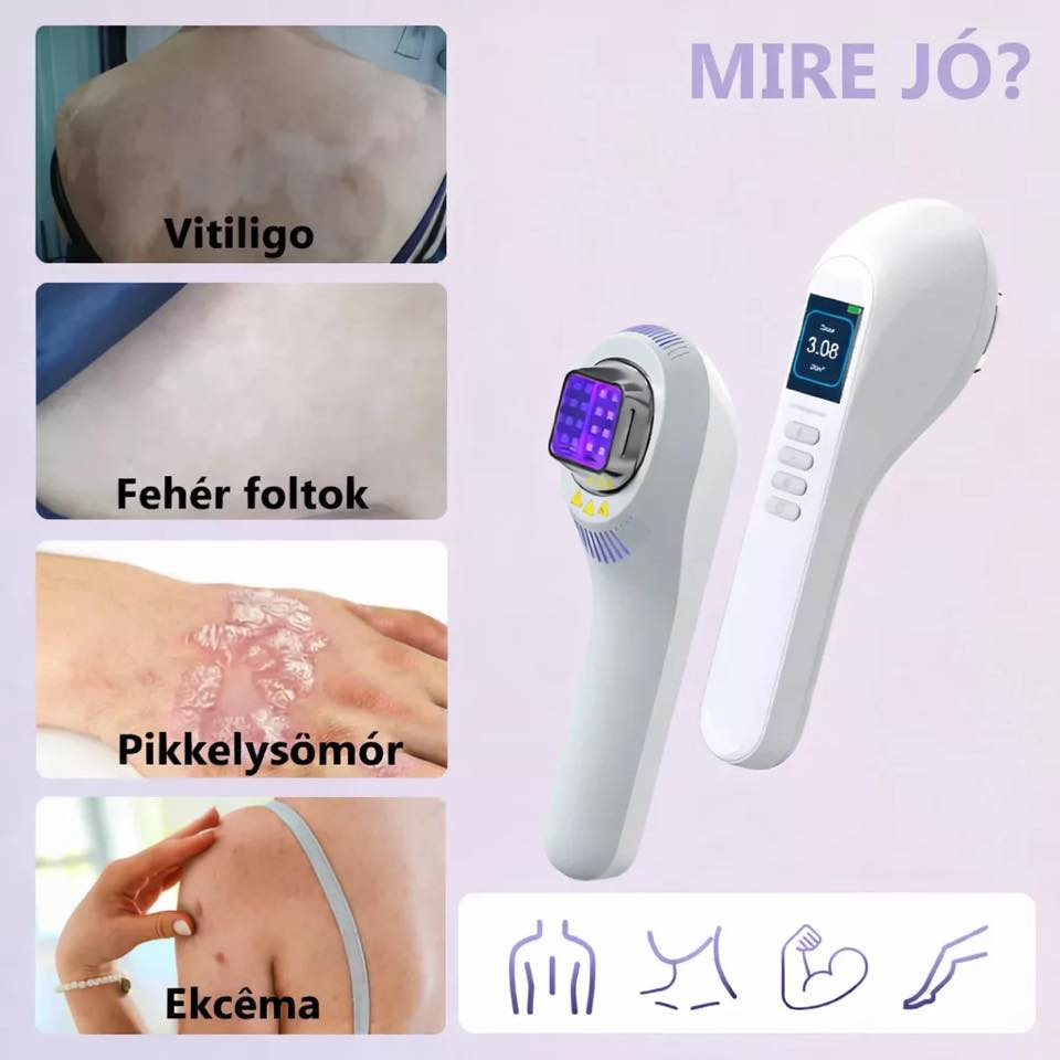 🔥 جهاز UVB 308 للعلاج الضوئي المنزلي – فعّال لـ:

🔹 البهاق (Vitiligo – Fehér foltok)
🔹 الصدفية (Pikkelysömör)
🔹 الأكزيما (Ekcéma)

هل تعاني من الصدفية، البهاق، أو الأكزيما؟ 👋 بدلاً من زيارات المستشفى المتعبة، جهاز UVB الضوئي يمنحك العلاج في منزلك بأمان وفعالية.

✨ لماذا هذا الجهاز؟

· ✅ يعالج الأعراض والسبب الجذري للمشكلة
· ✅ علاج منزلي بدون تكاليف إضافية أو زيارات مستشفى
· ✅ طيف ضيق 308 نانومتر – دقيق وآمن
· ✅ خفيف وقابل للحمل (أبعاد 25×17×8 سم)
· ✅ شاشة رقمية + مؤقت عد تنازلي + أزرار تحكم (+/-)
· ✅ بطارية داخلية ومنفذ شحن + فتحات تبريد

· الموديل: UL-01
· الجهد: محول عالمي 100-240 فولت (خرج 12V/4A)
🔹 معتمد CE + ضمان

جهاز UVB 308 هذا مخصص للعلاج الضوئي المنزلي هو نفس التقنية المستخدمة في المستشفيات لكن بحجم صغير تستخدمه لمدة دقائق حسب الجرعة الموصى بها. 

✅ الاستخدامات الطبية للجهاز:
علاج البهاق وتحفيز صبغة الجلد.
التخفيف من الصدفية وإزالة القشور.
تهدئة الإكزيما الحادة والتهابات البشرة.

📍 الموقع: العراق 🇮🇶
📬 للتواصل والاستفسار: يرجى إرسال رسالة خاصة على المسنجر، أو واتساب 
واتساب/ ‭0776 328 9823‬
