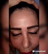 بوتوكس مكفول • فيرزاتشي بيوتي • اللاذقية