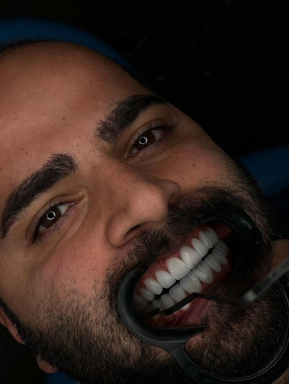 "🦷 أسنان صحية وابتسامة مشرقة...

في مراكز الشركة الطبية العالمية ، نوفر لك أحدث تقنيات طب الأسنان، وأسهل طرق الدفع.

✅ تقويم الأسنان ✅ تبييض الأسنان ✅ ابتسامة هوليوود
زراعة أسنان 
وحشوات وكتير من الخدمات 

متواجدين داخل المركز طيلة أيام الأسبوع لخدمتكم 

  #عيادة_اسنان #طب_اسنان #كي_كارد #KeeCard #دفع_الكتروني تقويم_اسنان تبييض_الاسنان زراعة_الاسنان ابتسامة جمال صحة

العنوان : طويريج _الشارع العام_مجاور نقابة المعلمين _مقابل المكتبة العامة _مجمع الحارث الطابق الثاني 

رقم الهاتف ***********
                ***********
