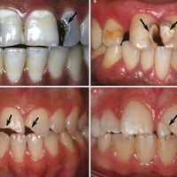 عين التمور • علاج أسنان • طول رمضان مجاني