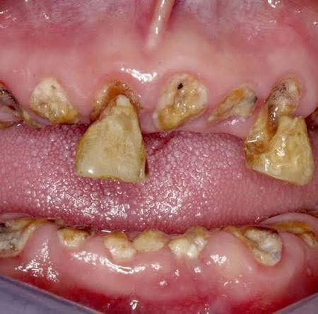 ‼️‼️🚨علاج مجاني تحت اشراف اطباء اختصاص
جامعة الفراهيدي كلية طب الاسنان


**إذا كنت صاحب هذا الإعلان وتريد حذفه لأي سبب، رجاءا أرسل رسالة إلى الدعم الفني**