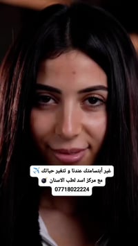 غير أبتسامتك عندنا و تتغير حياتك ✈️ مع مركز اسد التخصصي لطب وتجميل الأ...