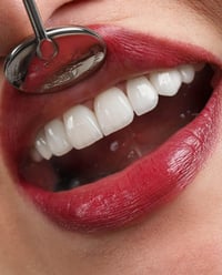 طب أسنان • زراعة أسنان • الديوانية