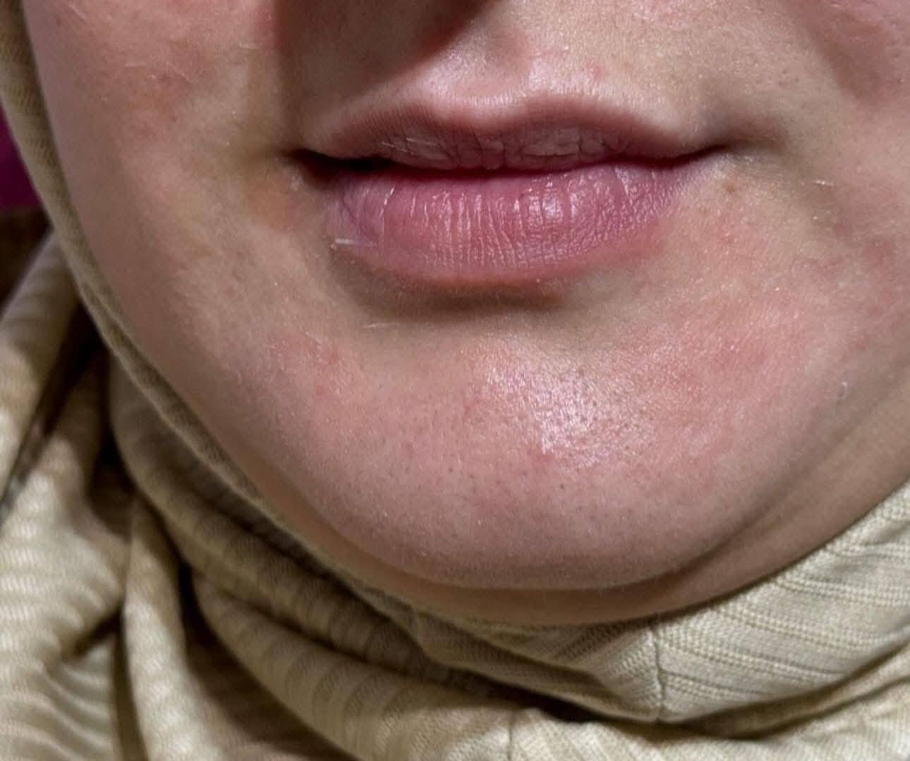 ✨ عروض لفترة محدودة | صالون الروان ✨
​دللي نفسكِ مع خبيرة التجميل الدكتورة انتصار
​نقدم لكِ أرقى الخدمات التجميلية بأحدث التقنيات لضمان إطلالة ساحرة وثقة لا حدود لها. استغلي الفرصة الآن قبل انتهاء مدة العرض!
​💄 أبرز خدمات قسم التجميل (بإشراف د. انتصار):
​علاجات البشرة: تنظيف بشرة عميق، هيدرافيشل، ونضارة فورية.
​الرتوش التجميلية: فيلر، بوتوكس، ورفع الحواجب.
​العناية المتقدمة: جلسات الميزوثيرابي والبلازما للشعر والبشرة.
​اللمسات النهائية: مكياج سينمائي ومكياج عرائس احترافي.
​📅 لماذا تختارين الدكتورة انتصار؟
​"الدقة في التنفيذ واللمسة الفنية التي تبرز جمالكِ الطبيعي هي شعارنا في قسم التجميل." العنوان كربلاء قنطرة السلام
***********
