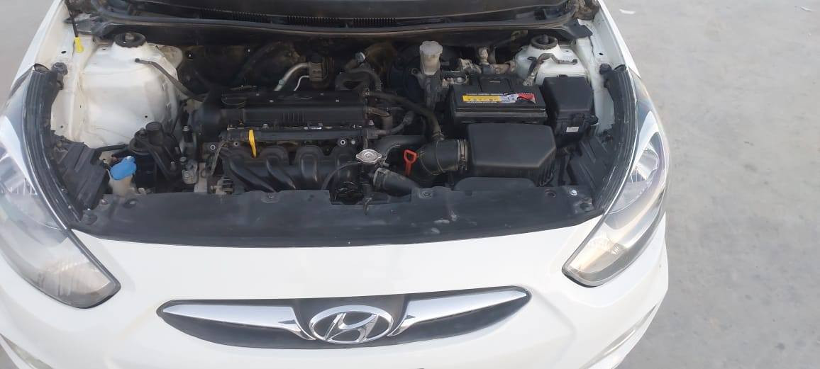 اكسن مديل ٢٠١٥ واسط تحويل مباشر بسم اخوي كفالة عامة وضع الشركة ماشية ٢٥٠ محرك ١٦٠٠ كفالة عامة السونار مرفق مع الصور محرك كير حدادية تبريد تخم داير سعر١١٣ بيهه مجال بسيط جدا رقم الموبايل *********** السيارة بلكوت العزة الجديدة مامتواجد على الفسي بك
