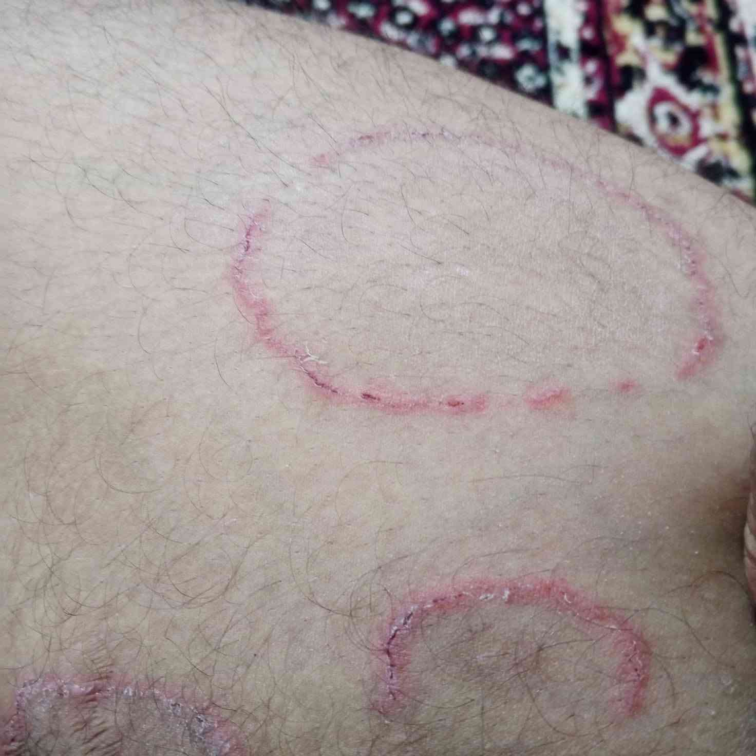 السلام عليكم من رخصة مدير الأكروب أخواني كل من لديه مرض جلدي بكل أنواعه مثل الفطريات والأزمه ولطفح والبهاق علاجه موجود بأذن الله علمأ المعنده كشفيه مجانآ بس العلاج بنصف قيمه *********** وتساب
اخوان تجبير الكسر ولفصخ وأبو صفار والملع عند الأطفال وأبو صفار والحجامه مجاني العنوان بغداد الغرير 
السلام عليكم من رخصة مدير الأكروب أخواني كل من لديه مرض جلدي بكل أنواعه مثل الفطريات والأزمه ولطفح والبهاق علاجه موجود بأذن الله علمأ المعنده كشفيه مجانآ بس العلاج بنصف قيمه *********** وتساب
