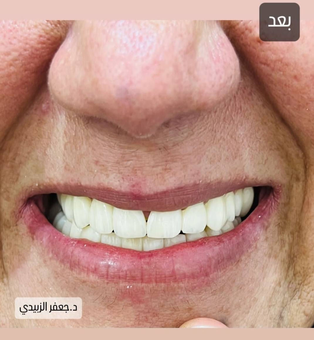 #تحيه_طيبه
سوف يتم بأذن الله التواجد في مجمع الشفاء الطبي الدبوني 
الدكتور جعفر حبيب الزبيدي
اختصاص طب وجراحة الفم والاسنان 
قلع-حشوات جذور-تقويم اسنان-تنظيف تبييض-تعويض الاسنان المفقود
#السبت_الاثنين_ليلآ
#الاربعاء_الخميس_الجمعة_عصرآ 
#الدبوني_خلف_صيدليه_زهراءمهدي
#في_مجمع_الشفاءالطبي_الدبوني
الاستفسار ***********
