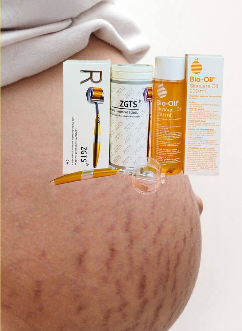 ✨ عرض علاج التشققات وتجديد البشرة للوجه والجسم ✨
احصلي على بشرة أنعم وأجمل مع مجموعة العناية المتكاملة ❤️

🧖‍♀️ أولاً: ديرمارول الأصلية 💯
تساعد على تجديد خلايا البشرة وتحفيز الكولاجين، وفوائدها:
✅ تقليل التشققات وعلامات التمدد
✅ تحسين مرونة وملمس الجلد
✅ تصغير المسام
✅ تخفيف آثار حب الشباب والندوب
✅ تقليل الخطوط والتجاعيد

🌿 ثانياً: زيت بايو أويل الأصلي 💯💯
زيت فعال لتحسين مظهر البشرة:
✅ تقليل التشققات والخطوط البيضاء
✅ توحيد لون البشرة والتصبغات
✅ تحسين آثار الندوب والحروق
✅ ترطيب البشرة الجافة ومنحها نعومة

سعر العرض ٢٠ الف 
يوجد توصيل لكل محافظات العراق ب٤الف


**إذا كنت صاحب هذا الإعلان وتريد حذفه لأي سبب، رجاءا أرسل رسالة إلى الدعم الفني**