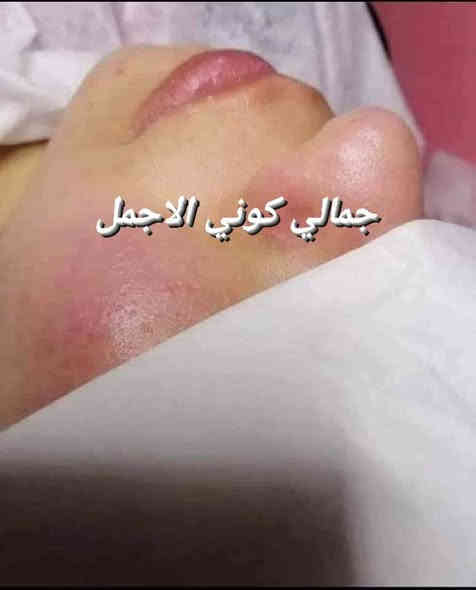 عروض كرسمس ،🎆🎀🎆
حفافة فقط 8

تنظيف بشرة 10بجهاز الهايدوفشل 

حفافة مع تنظيف بشرة بجهاز الهايدوفشل 15

المجموع قبل العرض 28

العرض صار المجموع 15
 

دللي نفسج وبسعر 15فقط 
حفافة مع تنظيف بشرة  كل هذا بسعر 15
صبغ الشعر القصير جداٍ بسعر 15 
الوسط 15
الطويل 25 

صبغ وميش للشعر القصير 35
فقط ميش 25
صبغ وميش للشعر الوسط 50
فقط ميش 35
صبغ وميش للشعر الطويل 65
فقط ميش 50

دكتورة رصابرين خبيره تجميل
عرض اول مره يصير حصري يمنا 
 
فلر كوري براند السعر السابق 150
السعر حالين سيسي واحد ب50
عرض يجنن ستغلو العرض ميتكرر

العرض ينتهي يوم 1/1

العنوان.  كربلاء قنطرة السلام
صالون الروان

💜أهلا وسهلا  ) 

الحجز وتساب ***********
H .M c🪻🪻🪻🪻🪻🪻🪻🪻🪻🪻🪻🪻🪻#عيادات_تجميل #اطباء #مراكز_تجميل #مخدر_موضعي #فلر #ميزوات #بلازما_البشرة #طبيبات_جلدية  #بغداد_العراق #صالونات #ميزو #فلر #ميزو_فلر #مراكزتجميل #عيادات_تجميل #اطباء #صالونات #بغداد_العراق #مستحضرات_تجميلية#بوتوكس #ميزو #بشره #جلد #جمال #فلرات #شفاه
@إشارة
