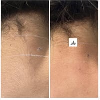 جلسة اولى • حجز جلسات • العبيدي