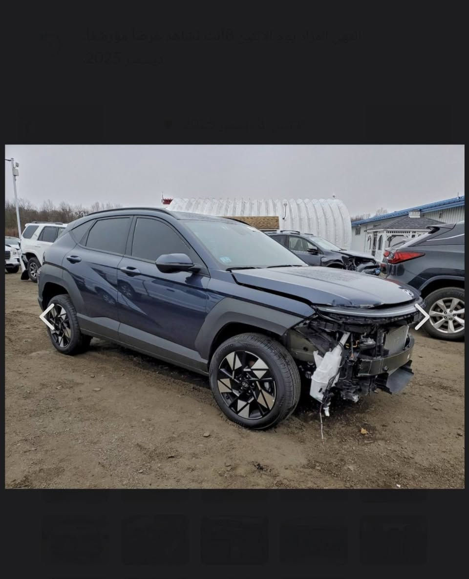 السلام عليكم كونا موديل 2025 السياره مكفوله فقط دعاميه مبدله صور الحادث مرفوقه بالمنشور  السياره جديده مابيه اي نفص كامله السياره بدون رقم مكاني بابل *********** وبيه وتساب السعر 170 وبيه مجال
