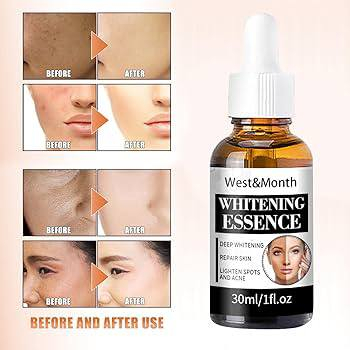 السلام عليكم منتجات كوريه وميحتاج اشرح عن المنتجات الكوريه والصينيه.. 
القطعه ع 5الاف 
ويوجد توصيل لجميع المحافظات 5الاف 
ممكن الموافقه ادمن اكون ممنونه


**إذا كنت صاحب هذا الإعلان وتريد حذفه لأي سبب، رجاءا أرسل رسالة إلى الدعم الفني**