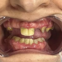 زاركون ألماني • ضمان مدى الحياة • عيادة حي النصر