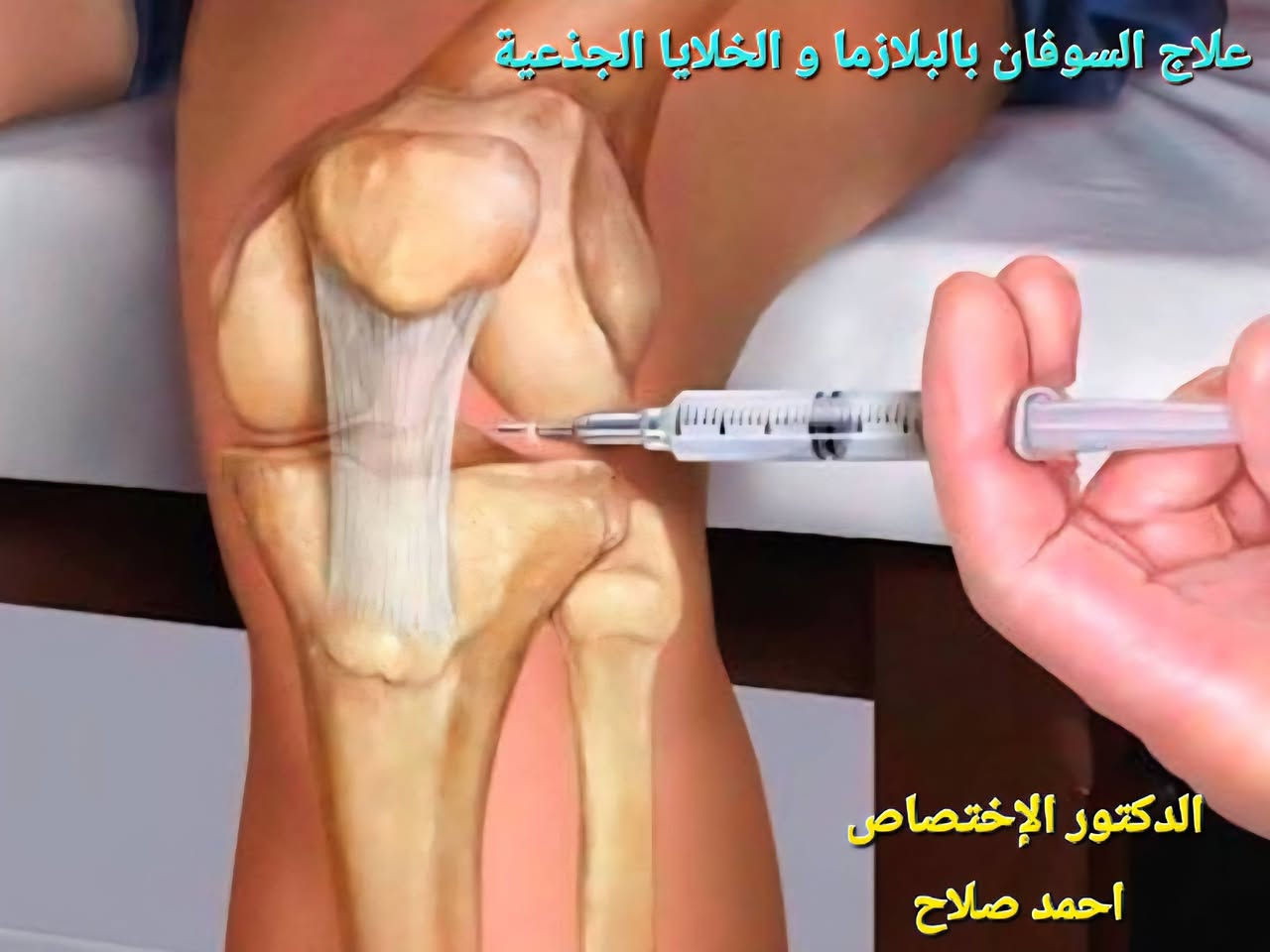١.علاج السوفان بحقن البلازما و الخلايا الجذعية و الابر الجلاتينية  بدلالة السونار
٢.علاج انزلاق الفقرات القطنية والعنقية بجهاز سحب الفقرات الكهربائي
٣.علاج نتوء الكعب بجهاز تفتيت التكلسات
٤. علاج المفاصل بالليزر البارد الحديث
٥. العلاج آلام المفاصل بالابر الصينية
٦. تأهيل اصابات الاعصاب و الكسور بأجهزة التحفيز الكهربائي و الحمام الشمعي
٧. فحص هشاشة العظام 
الدكتور الإختصاص احمد صلاح اختصاص أمراض المفاصل و الروماتيزم و التأهيل الطبي 
بغداد.حي الجهاد .استدارة السوق الشعبي مقابل إنشائية البشير ٢
للحجز والاستفسار 
***********
