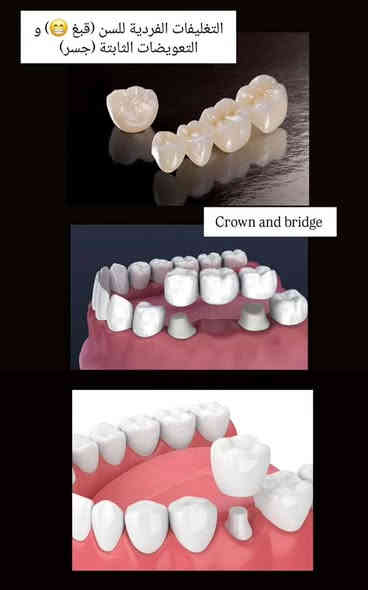 نقلاََ عن الشيخ غانم حازم الراشدي تعلن طلبة كلية طب الأسنان عن استقبال المواطنين في مقر الكلية
علما ان أجور العمل مجانيه عدا أجور المختبر لجميع الحالات المذكورة أعلاه... للراغبين الاتصال على الرقم *********** مع تحياتي والسلامه والعافيه للجميع

