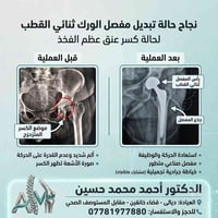 بورد جراحة عظام • مفاصل وكسور • خانقين