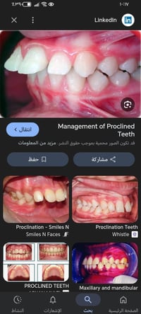 تقييم حالات • طب الاسنان الرمادي • سعر رمزي