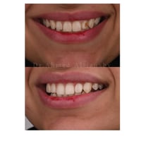 عيادة أسنان • المحمودية • أقساط