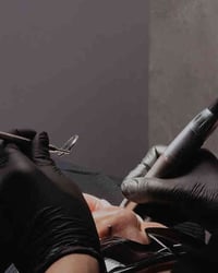 الـسلام عـلـيكم منو محتاج قلع الأسنان التالفة وبقايا الجذور يتفضل خاص ...