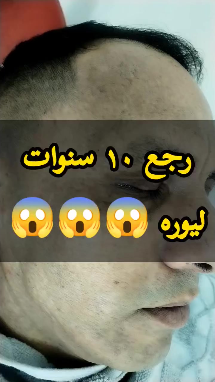 #العيد_ميصير_عيد اذا متروح لكمر 😎
للحجز مراسلة الصفحه
واتساب ***********
واتساب ***********
