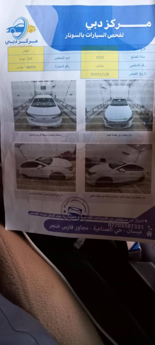 الترا 20 خليجي كامل مواصفات مكفولة كفاله عامه من التبديل  والصبغ  155 وبيها مجال حك لجيه  مكان لسياره ميسان لكحلاء  ***********
