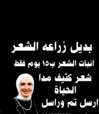 بديل زراعة الشعر • منتج طبيعي • تجميل