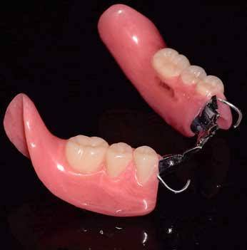 مجانا.
قلع الاسنان التالفه والجذور المتبقيه
حشوات ضوئيه تجميليه 
تنضيف الاسنان 
طقم اسنان متحرك جزئي
علما ان العلاج مجاني 
للتواصل الاتصال على الرقم التالي او التواصل على الواتساب ***********
انستا @_2__ii
كربلاء
خلف مول الحارث
