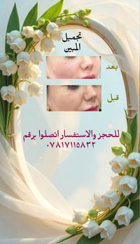 تجميل خدود • شد ورفع • حجز مسبق