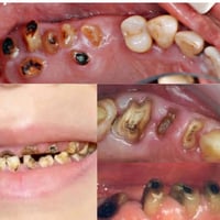 اللي محتاج قلع مجاني   يتواصل واتساب 07849832584 جامعة الهادي نهاية شا...