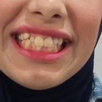 عياده الدكتور عماد عطا الله البدري لزراعه وتقويم الاسنان رقم عياده 078...